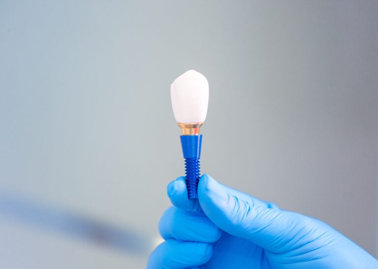 Implant restorations Lancaster